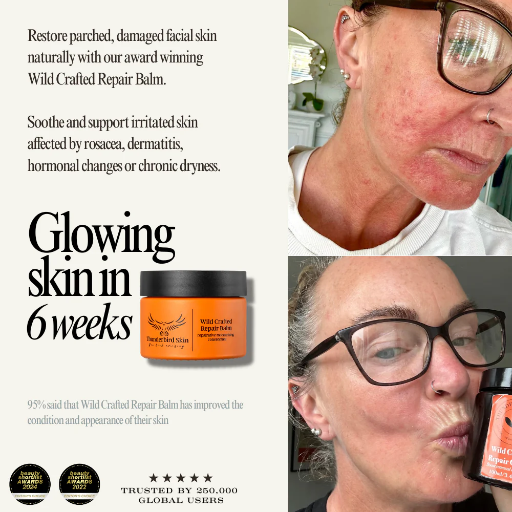 Wild Crafted Repair Balm - Image 10