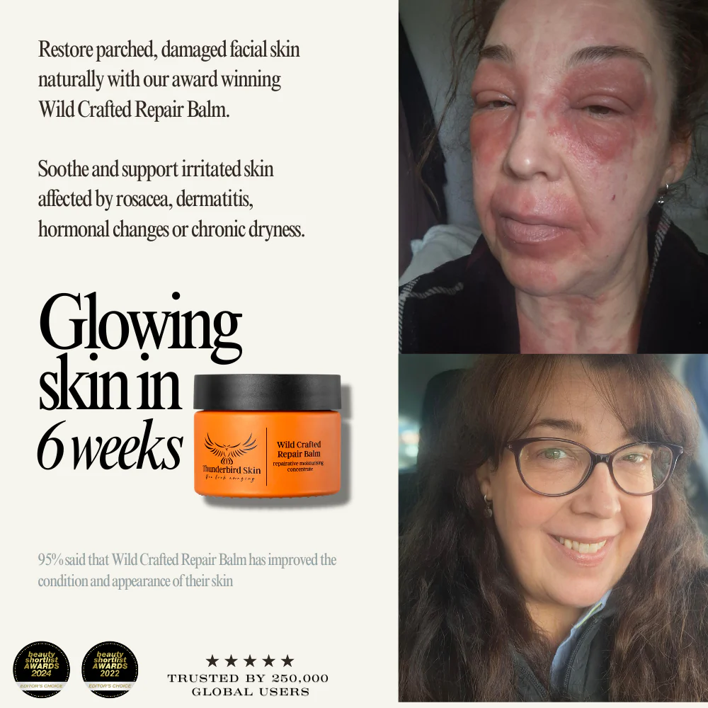Wild Crafted Repair Balm - Image 4