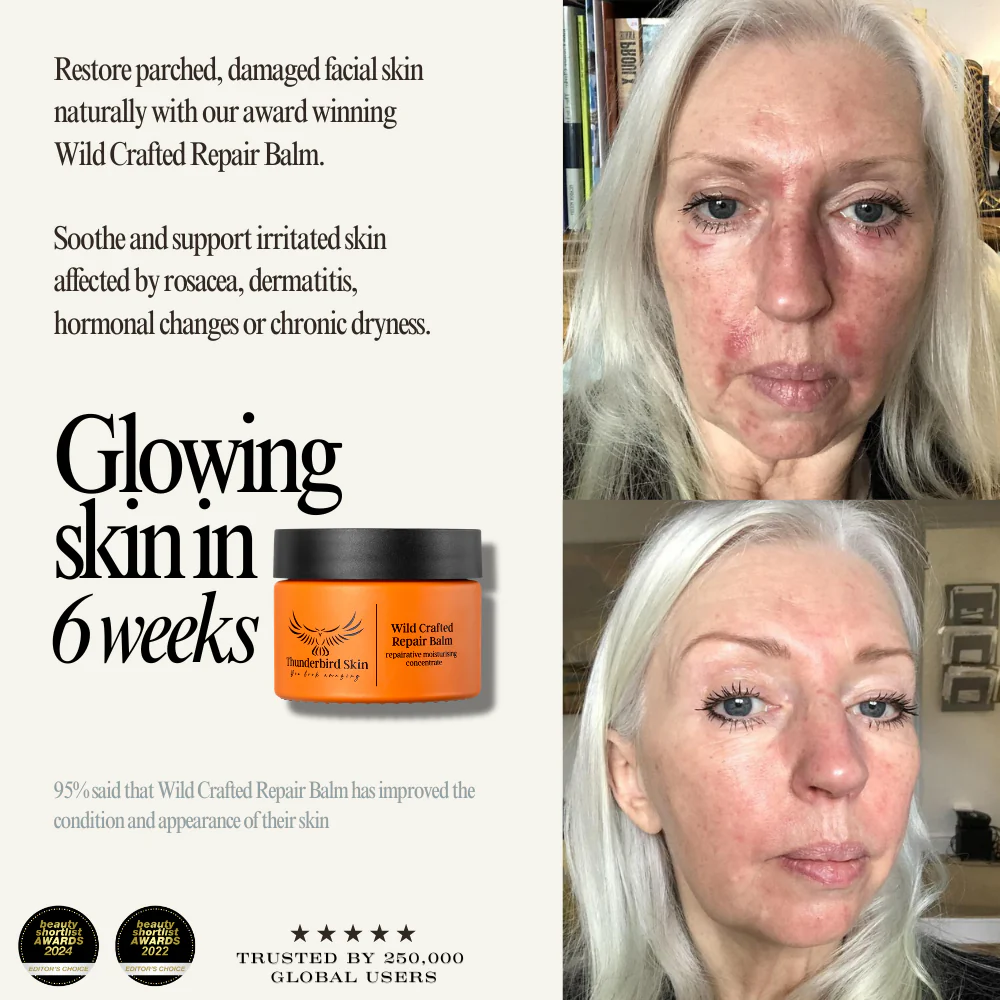 Wild Crafted Repair Balm - Image 6
