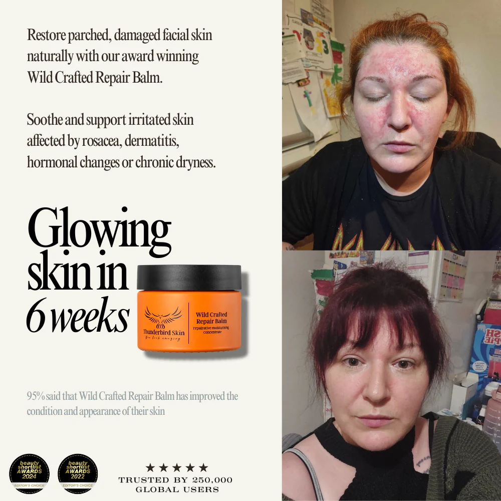 Wild Crafted Repair Balm - Image 9